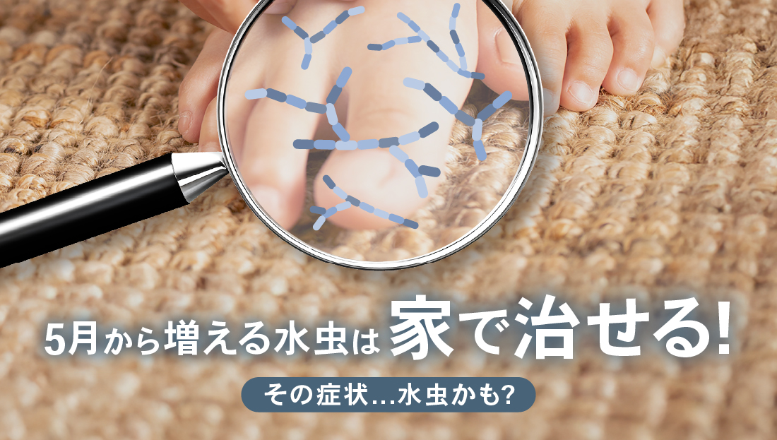 その症状水虫かも？水虫は家で治せる！